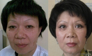 ПЛАСТИЧЕСКАЯ И ЭСТЕТИЧЕСКАЯ ХИРУРГИЯ #533305