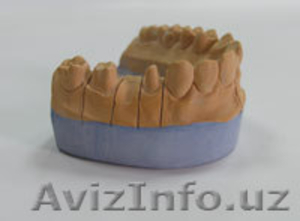 Продам Супер гипс для зубных техников и для стоматологов. #954287