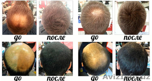 Средство для Роста волос,  бороды  Лечение облысение  #1587632