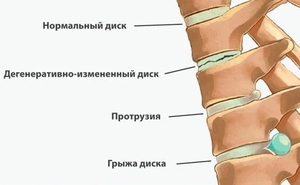 Лечебный- медицинский массаж #1746529